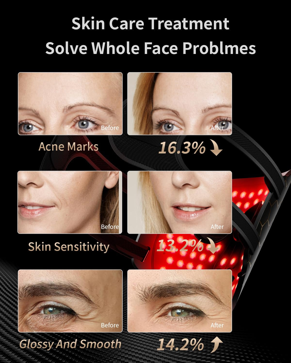 Revitalize Your Skin with the 7-Color LED Facial Mask - Anti-Aging & Tightening (Black)
